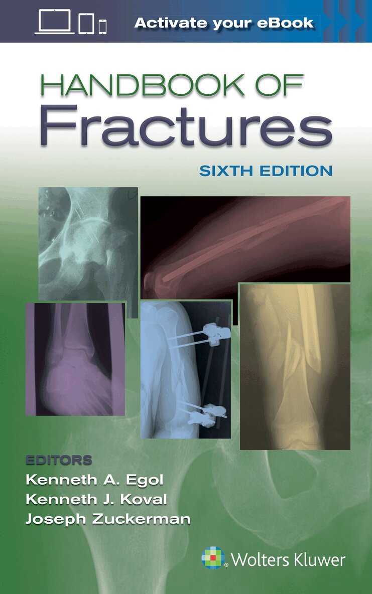 Kenneth Egol - Handbook of Fractures, Häftad. Tillgänglighet: Tillfälligt slut