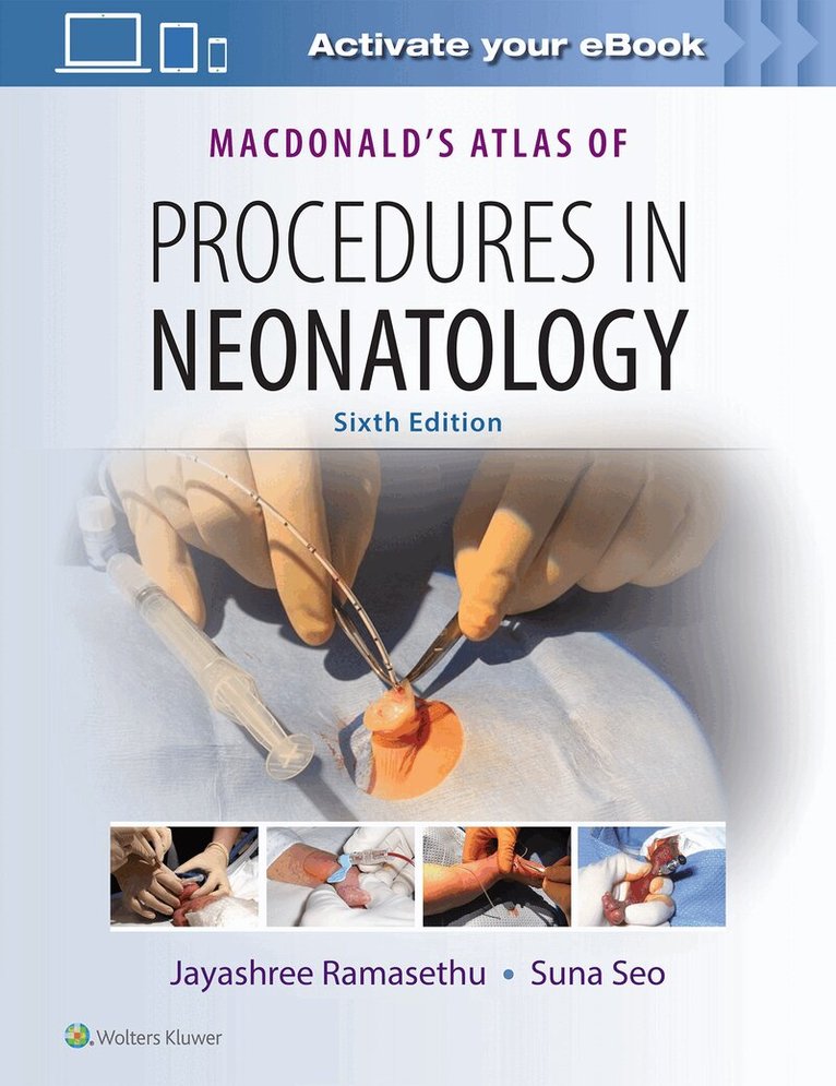 Jayashree Ramasethu, Suna Seo - MacDonald's Atlas of Procedures in Neonatology, Inbunden