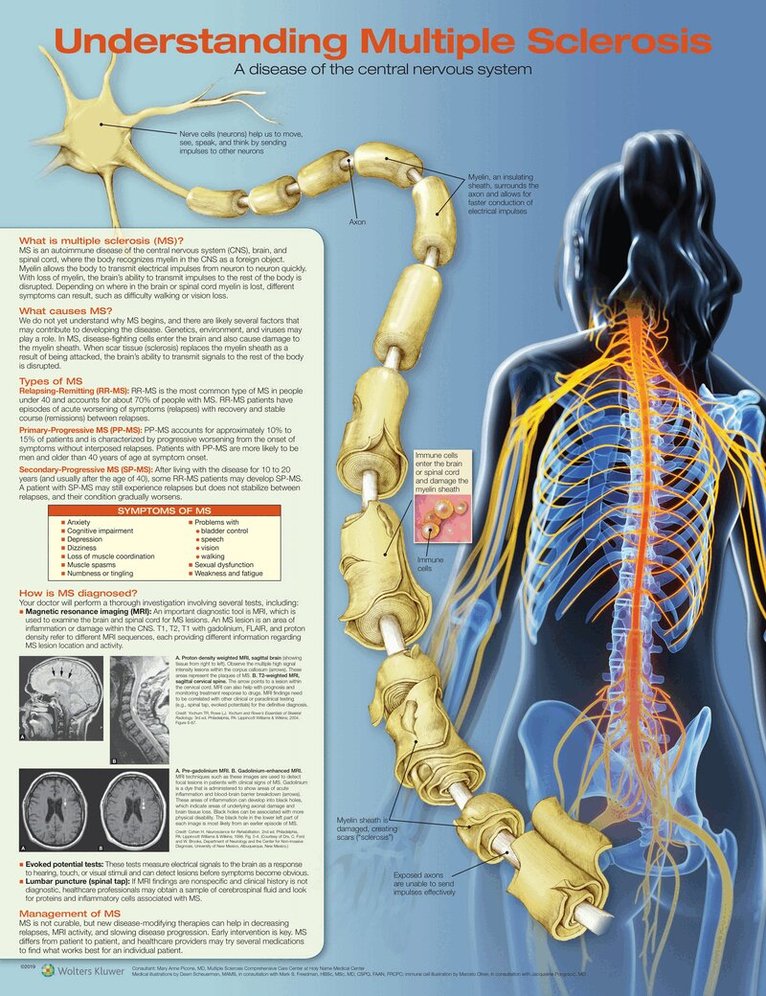 Understanding Multiple Sclerosis Anatomical Chart, Övrigt