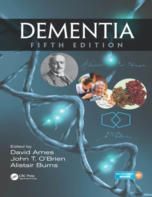 Alistair Burns, John T. O'Brien, David Ames - Dementia, E-bok