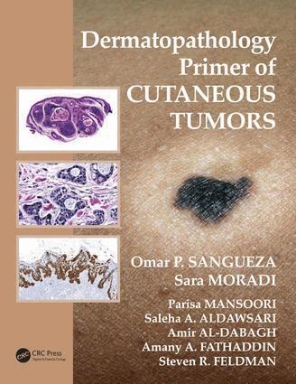 Omar P. Sangueza, Sara Moradi, Parisa Mansoori, Saleha Aldawsari, Amir Al-Dabagh, Amany Abdulgader Fathaddin, Steven R. Feldman - Dermatopathology Primer of Cutaneous Tumors, E-bok