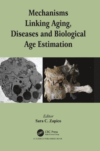 Sara C. Zapico - Mechanisms Linking Aging, Diseases and Biological Age Estimation, E-bok