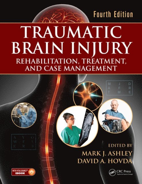 David A. Hovda, Mark J. Ashley - Traumatic Brain Injury, E-bok. Tillgänglighet: Lägg i varukorg
