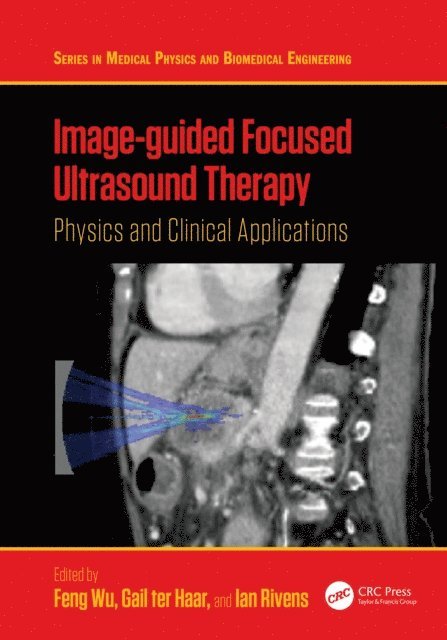 Ian Rivens, Gail ter Haar, Feng Wu - Image-guided Focused Ultrasound Therapy, E-bok