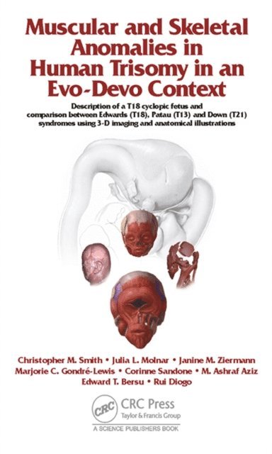Mohammed Ashraf Aziz, Edward T. Bersu, Corinne Sandone, Marjorie C. Gondre-Lewis, Julia Molnar, Janine M. Ziermann, Christopher M. Smith, Rui Diogo - Muscular and Skeletal Anomalies in Human Trisomy in an Evo-Devo Context, E-bok
