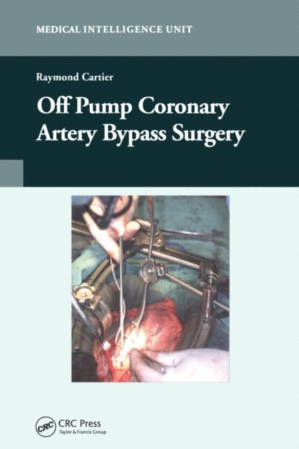 Raymond Cartier - Off-Pump Coronary Artery Bypass Surgery, E-bok. Tillgänglighet: Lägg i varukorg