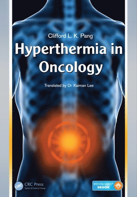 Clifford L. K. Pang - Hyperthermia in Oncology, E-bok. Tillgänglighet: Lägg i varukorg
