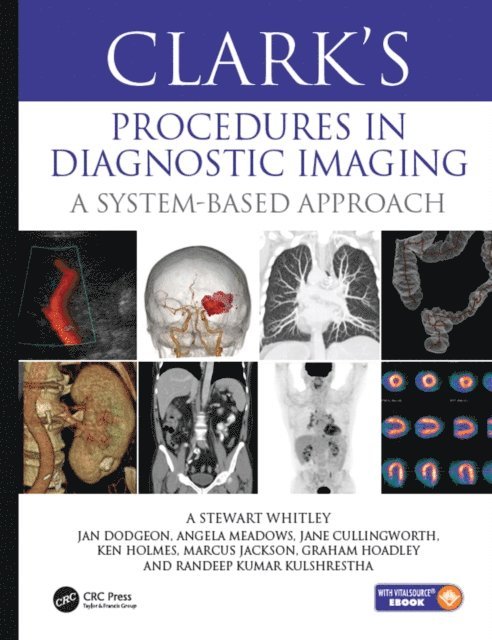Randeep Kulshrestha, Graham Hoadley, Marcus Jackson, Ken Holmes, Jane Cullingworth, Angela Meadows, Jan Dodgeon, A Stewart Whitley - Clark's Procedures in Diagnostic Imaging, E-bok