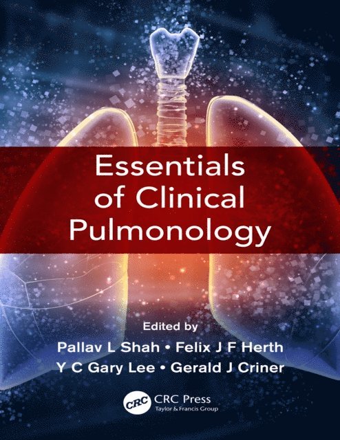 Gerard J Criner, YC Gary Lee, Felix JF Herth, Pallav L Shah - Essentials of Clinical Pulmonology, E-bok