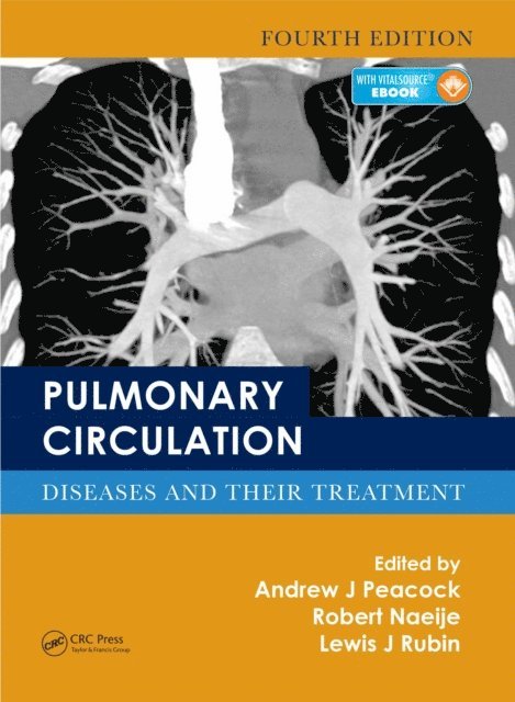 Lewis J. Rubin, Robert Naeije, Andrew J. Peacock - Pulmonary Circulation, E-bok