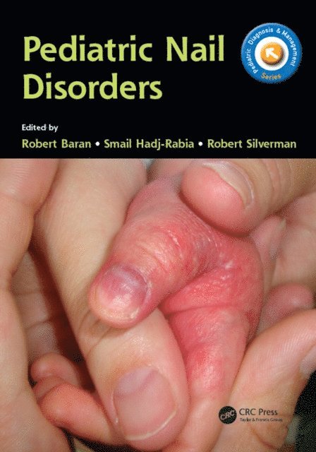 Robert Silverman, Smail Hadj-Rabia, Robert Baran - Pediatric Nail Disorders, E-bok