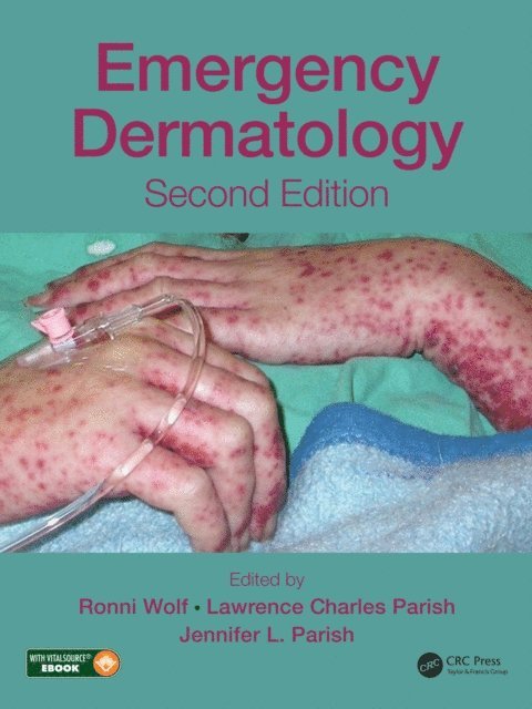 Jennifer L. Parish, Lawrence Charles Parish, Ronni Wolf - Emergency Dermatology, E-bok