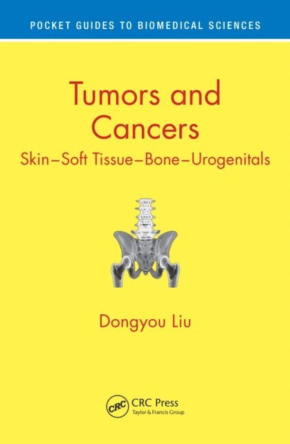 Dongyou Liu - Tumors and Cancers, E-bok