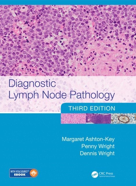 Dennis Wright, Penny Wright, Margaret Ashton-Key - Diagnostic Lymph Node Pathology, E-bok