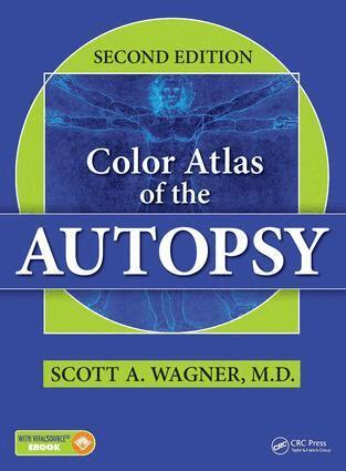 Scott A. Wagner - Color Atlas of the Autopsy, Inbunden. Tillgänglighet: Lägg i varukorg