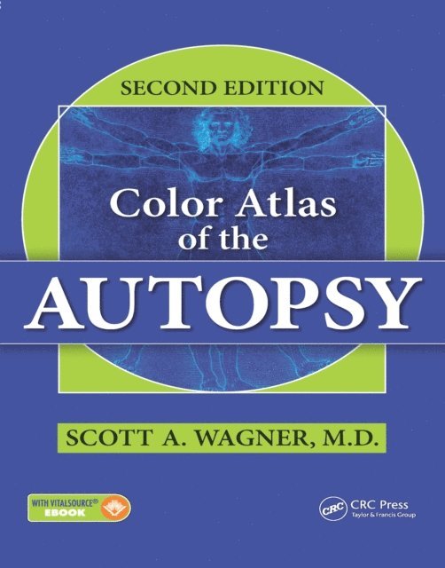 Scott A. Wagner - Color Atlas of the Autopsy, E-bok. Tillgänglighet: Lägg i varukorg