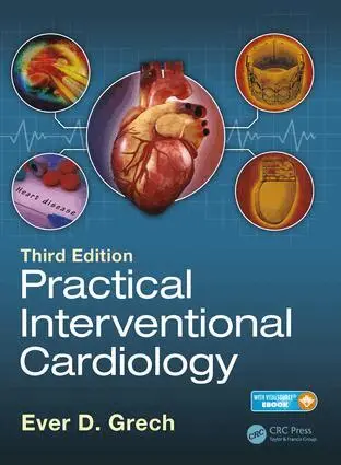 Ever D. Grech - Practical Interventional Cardiology, Inbunden. Tillgänglighet: Lägg i varukorg