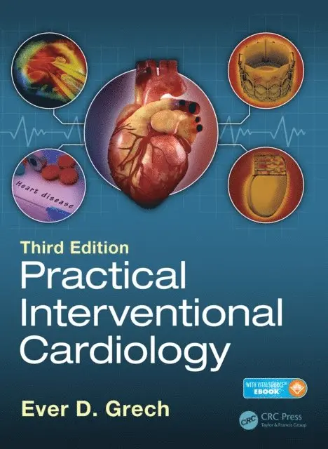 Ever D. Grech - Practical Interventional Cardiology, E-bok. Tillgänglighet: Lägg i varukorg