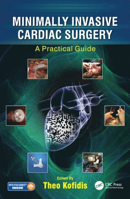 Theo Kofidis - Minimally Invasive Cardiac Surgery, E-bok