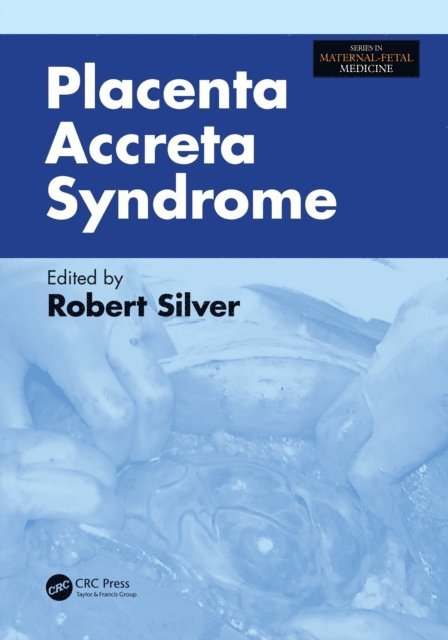 Robert Silver - Placenta Accreta Syndrome, E-bok