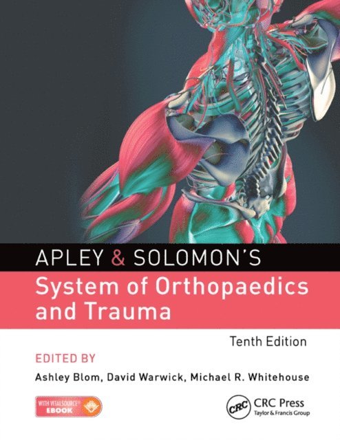Michael Whitehouse, David Warwick, Ashley Blom - Apley & Solomon's System of Orthopaedics and Trauma, E-bok