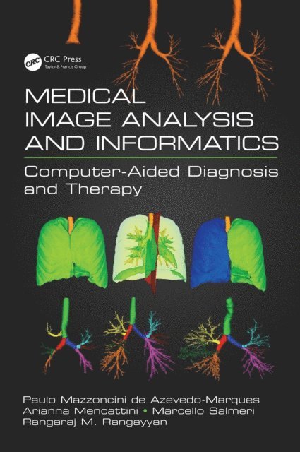 Rangaraj M. Rangayyan, Marcello Salmeri, Arianna Mencattini, Paulo Mazzoncini de Azevedo-Marques - Medical Image Analysis and Informatics, E-bok