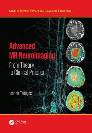 Ioannis Tsougos - Advanced MR Neuroimaging, Inbunden. Tillgänglighet: Lägg i varukorg