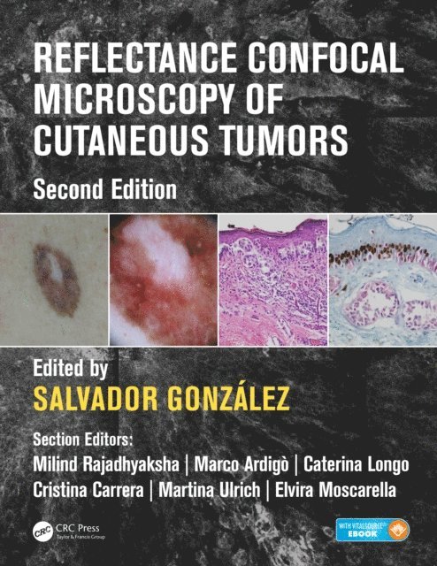 Salvador Gonzalez - Reflectance Confocal Microscopy of Cutaneous Tumors, E-bok. Tillgänglighet: Lägg i varukorg