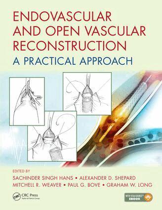 Sachinder Singh Hans - Endovascular and Open Vascular Reconstruction, Inbunden