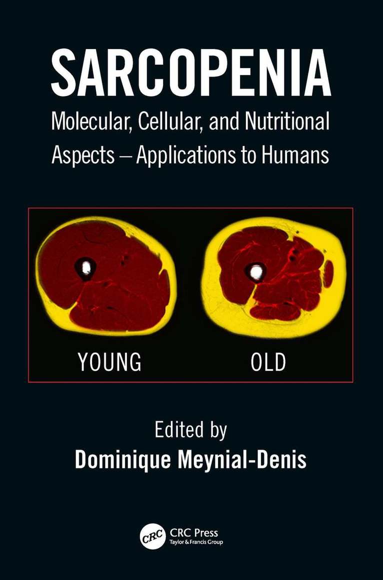 Dominique Meynial-Denis - Sarcopenia, Inbunden