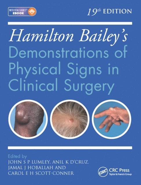 Carol E. H. Scott-Connor, Jamal K. Hoballah, Anil K. D'Cruz, John S. P. Lumley - Hamilton Bailey's Physical Signs, E-bok