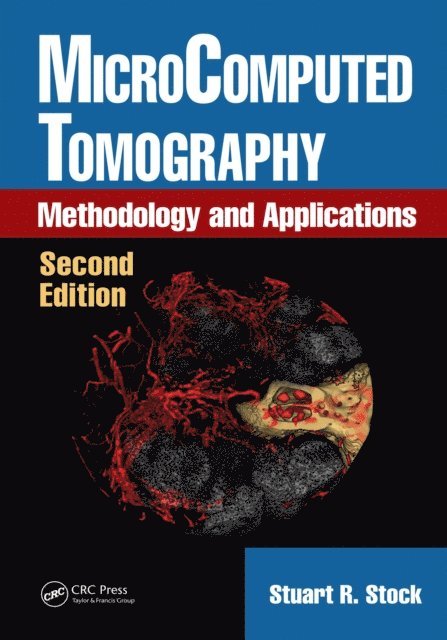 Stuart R. Stock - MicroComputed Tomography, E-bok