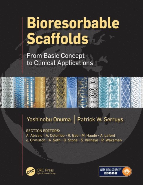 Patrick W.J.C. Serruys, Yoshinobu Onuma - Bioresorbable Scaffolds, E-bok