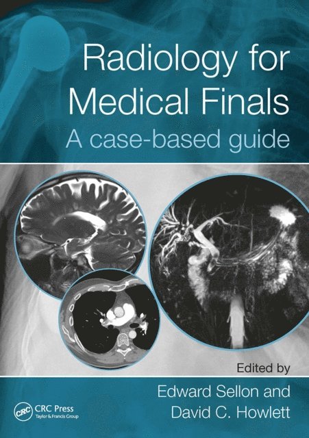 David Howlett, Edward Sellon - Radiology for Medical Finals, E-bok