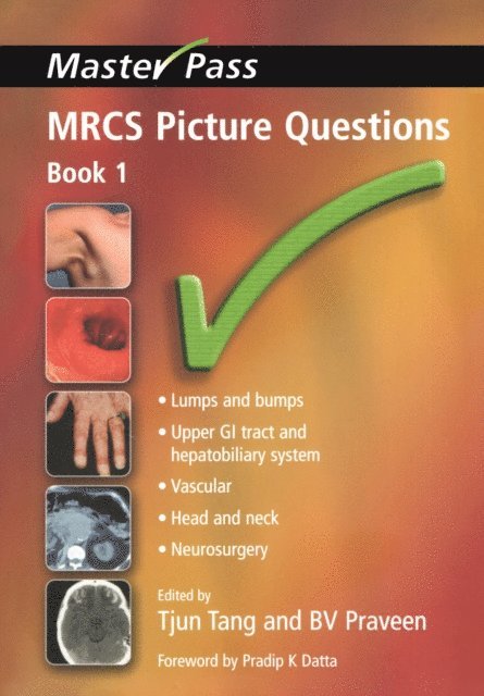 B V Praveen, Tjun Tang - MRCS Picture Questions, E-bok. Tillgänglighet: Lägg i varukorg