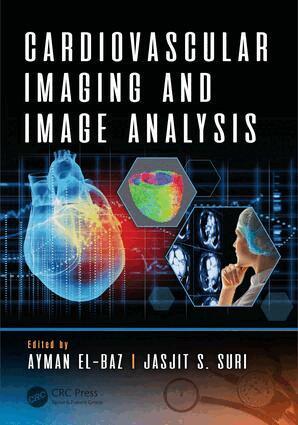 Ayman El-Baz, Jasjit S. Suri - Cardiovascular Imaging and Image Analysis, Inbunden
