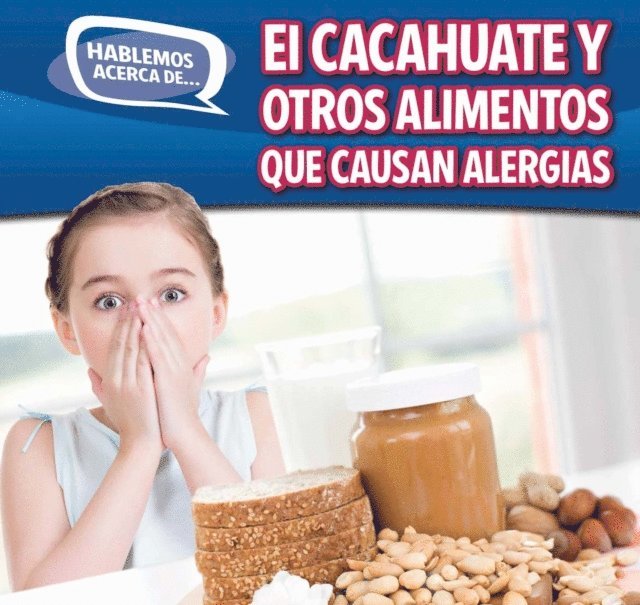 Caitie McAneney - El cacahuate y otros alimentos que causan alergias (Peanut and Other Food Allergies), E-bok. Tillgänglighet: Lägg i varukorg