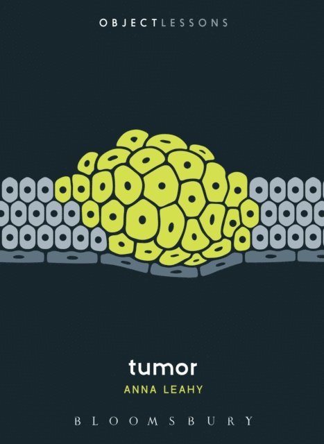 Anna Leahy - Tumor, E-bok