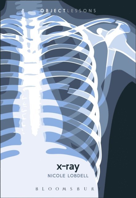 Nicole Lobdell - X-ray, E-bok