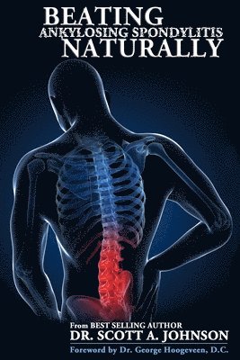 Scott A Johnson - Beating Ankylosing Spondylitis Naturally, Häftad. Tillgänglighet: Lägg i varukorg