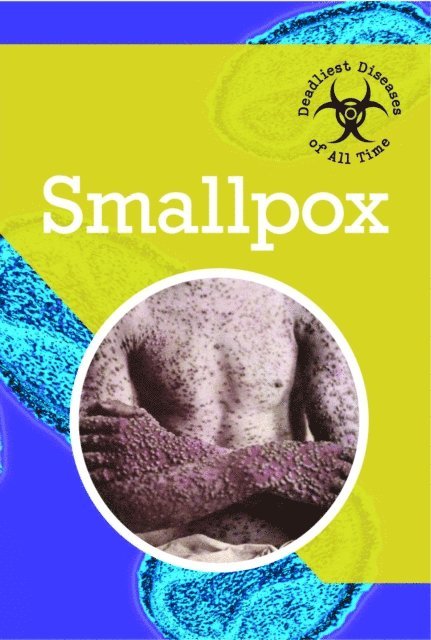 Lawrence Andrews - Smallpox, E-bok