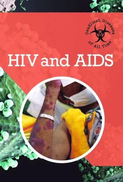 Randall McPartland - HIV and AIDS, E-bok. Tillgänglighet: Lägg i varukorg