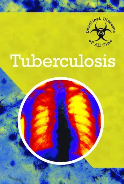 Randall McPartland - Tuberculosis, E-bok. Tillgänglighet: Lägg i varukorg