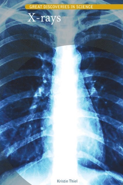 Kristin Thiel - X-rays, E-bok