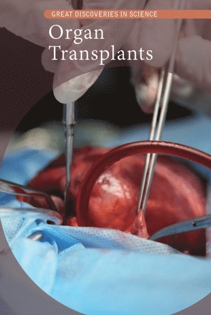 Cathleen Small - Organ Transplants, E-bok