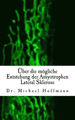Michael Hoffmann - Über die mögliche Entstehung der Amyotrophen Lateral Sklerose, Häftad. Tillgänglighet: Lägg i varukorg