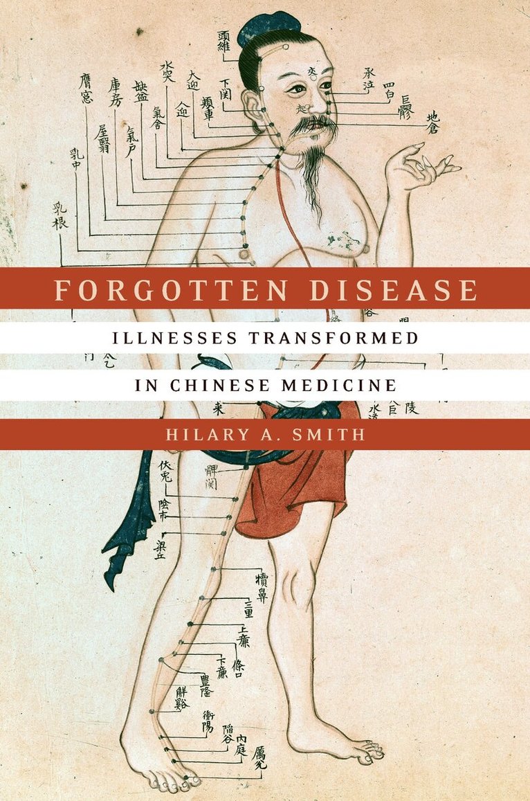 Hilary A. Smith - Forgotten Disease, E-bok