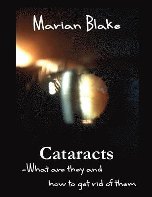 Marian Blake - Cataracts: What are they and how to get rid of them?, Häftad. Tillgänglighet: Lägg i varukorg