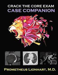 Prometheus Lionhart M. D. - Crack the CORE Exam - Case Companion, Häftad
