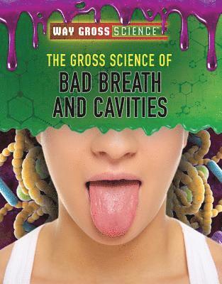 Jessica Shaw - The Gross Science of Bad Breath and Cavities, Häftad